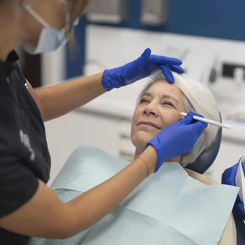 Blefaroplastia 