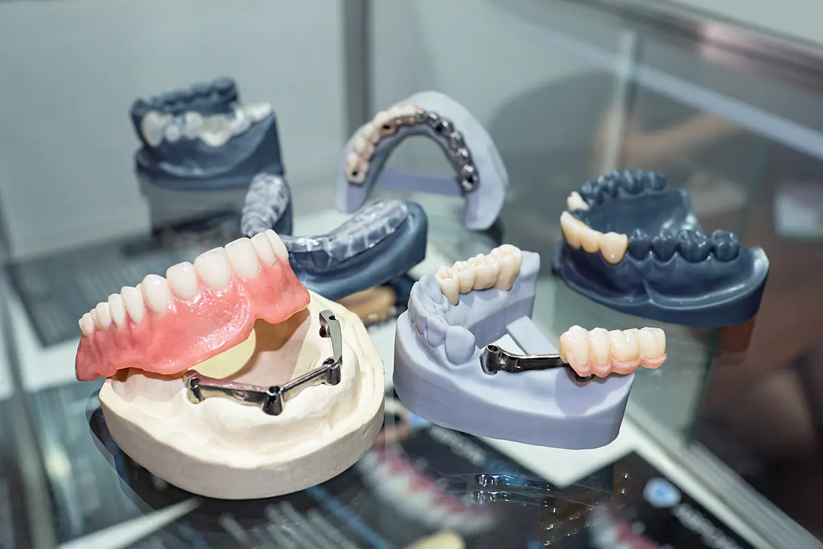 Estructuras microfresadas