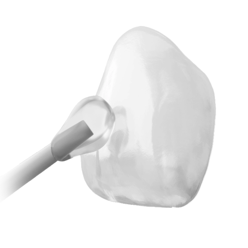 Tratamiento de carillas dentales