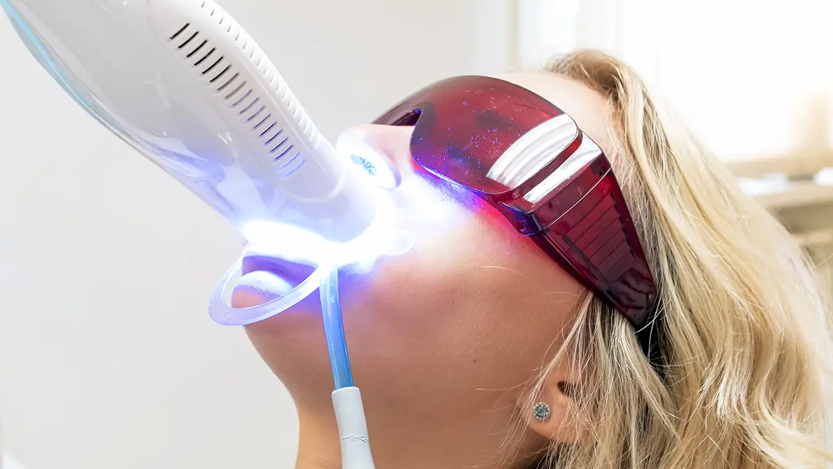 Blanqueamiento dental