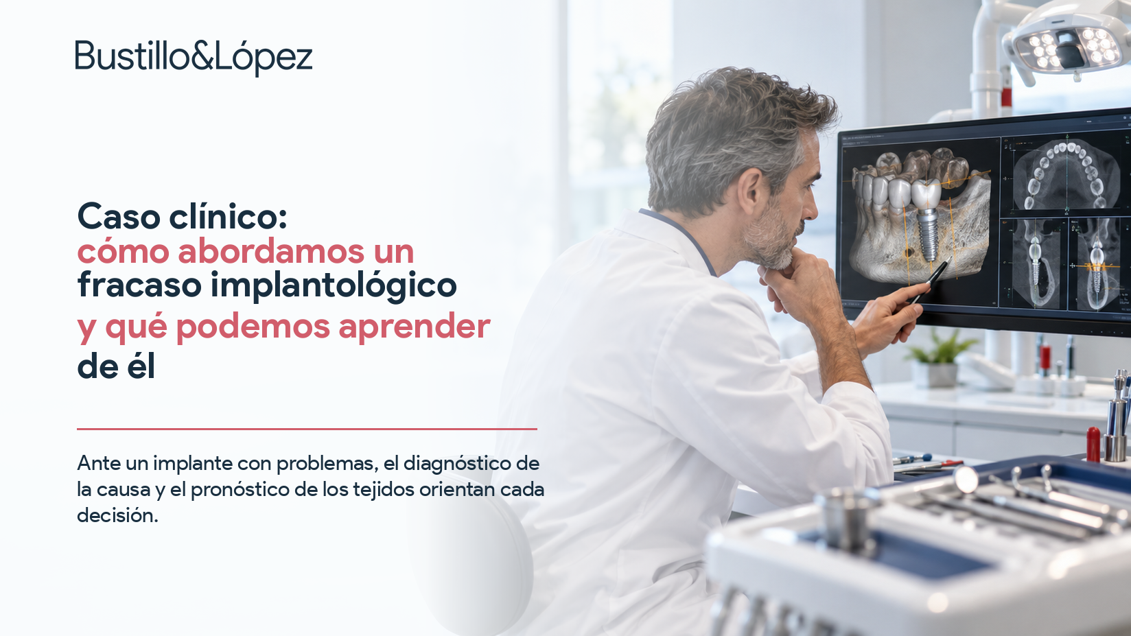 Odontólogo revisando un caso de fracaso implantológico en imágenes diagnósticas