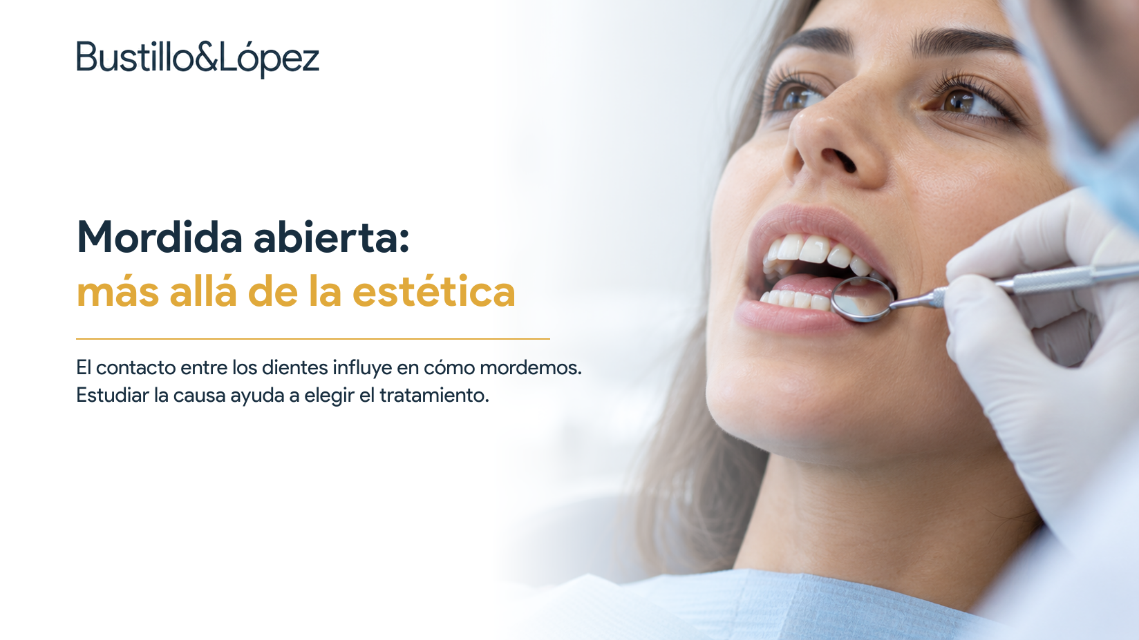 Mordida abierta: qué la provoca y por qué no es solo un problema estético